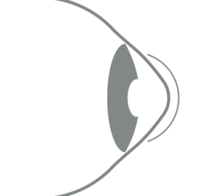 2024-387 - Vision Camberwell - Illustration RGP Contact Lens 2024-387 - Vision Camberwell - Illustration RGP Contact Lens